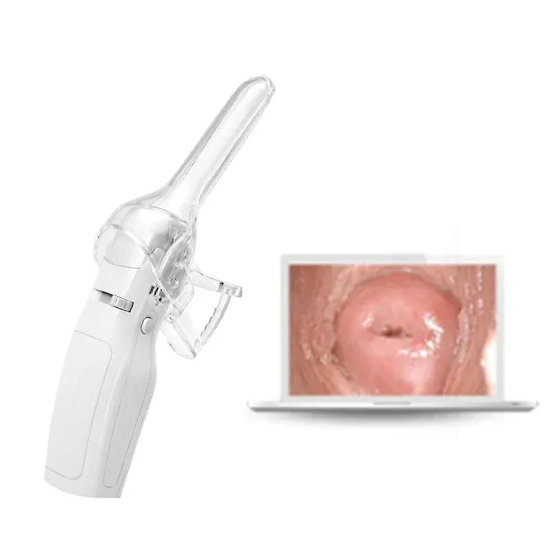 Mini Colposcope with Digital Video for Accurate and Convenient Health Monitoring Optional Monitors Self-testing Accessories