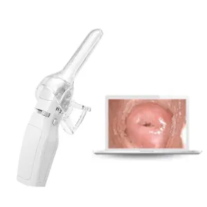 Mini Colposcope with Digital Video for Accurate and Convenient Health Monitoring Optional Monitors Self-testing Accessories