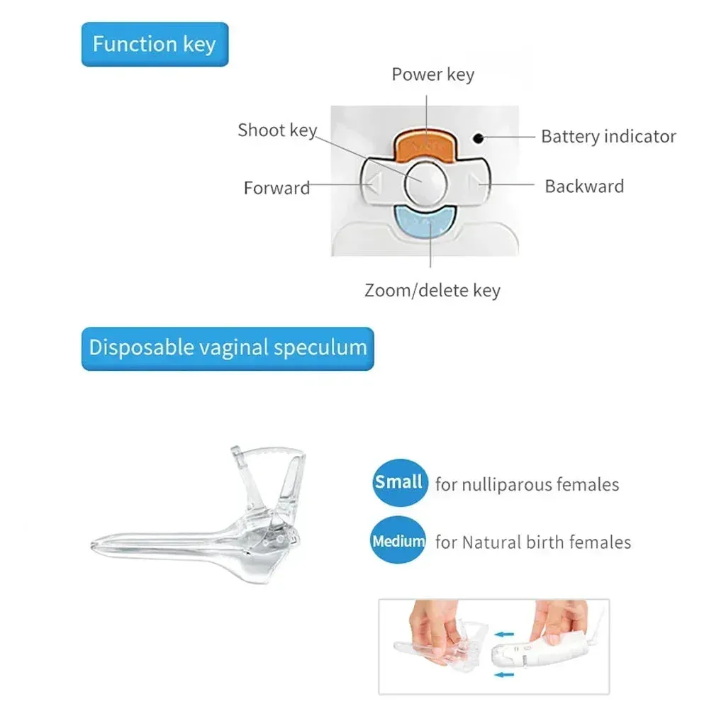 Mini Colposcope with Digital Video for Accurate and Convenient Health Monitoring Optional Monitors Self-testing Accessories